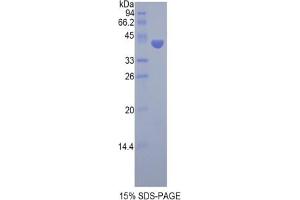 SDS-PAGE analysis of Pig FSHb Protein. (FSHB Protein)