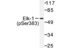 Image no. 1 for anti-ELK1, Member of ETS Oncogene Family (ELK1) (pSer383) antibody (ABIN318012) (ELK1 antibody  (pSer383))