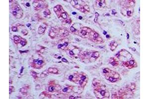 Image no. 1 for anti-Bone Marrow Stromal Cell Antigen 2 (BST2) (AA 80-130) antibody (ABIN960102) (BST2 antibody  (AA 80-130))