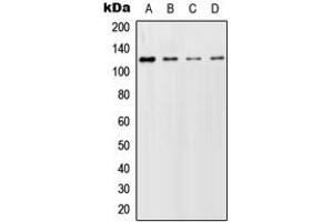 Western blot analysis of GCFC2 expression in HeLa (A), SP2/0 (B), PC12 (C) whole cell lysates. (GCFC2 antibody  (Center))
