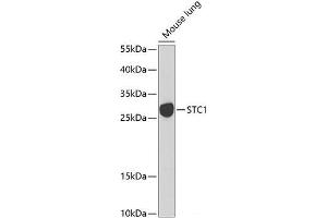 Western blot analysis of extracts of Mouse lung using STC1 Polyclonal Antibody at dilution of 1:1000. (Stanniocalcin 1 antibody)