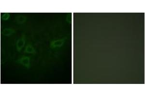 Immunofluorescence analysis of HepG2 cells, using TK (Ab-13) Antibody. (TK (AA 1-50) antibody)