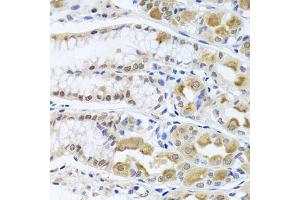 Immunohistochemistry of paraffin-embedded human stomach using TRMT1 antibody (ABIN5975089) at dilution of 1/100 (40x lens). (TRMT1 antibody)