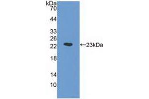 Western Blot; Sample: Recombinant a1AGP, Human. (ORM1 antibody  (AA 19-201))