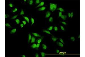 Immunofluorescence of monoclonal antibody to EIF2AK2 on HeLa cell. (EIF2AK2 antibody  (AA 1-100))