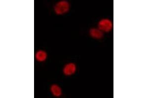 ABIN6275603 staining Hela by IF/ICC. (SF3B3 antibody  (C-Term))