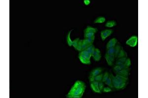 Immunofluorescent analysis of MCF-7 cells using ABIN7160462 at dilution of 1:100 and Alexa Fluor 488-congugated AffiniPure Goat Anti-Rabbit IgG(H+L) (MNDA antibody  (AA 84-233))