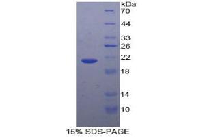 SDS-PAGE analysis of Human GaA Protein.