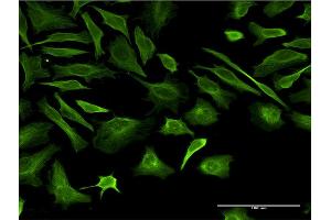 Immunofluorescence of monoclonal antibody to TUBB2A on HeLa cell. (TUBB2A antibody  (AA 1-445))