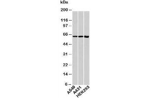 Western blot testing of human samples with HSP60 antibody at 1ug/ml. (HSPD1 antibody)