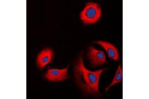 Immunofluorescent analysis of Collagen 11 alpha 1 staining in K562 cells. (COL11A1 antibody  (Center))