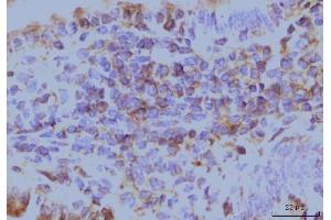IHC analysis of EIF4A1 using anti-EIF4A1 antibody (ABIN7603144). (EIF4A1 antibody  (N-Term))