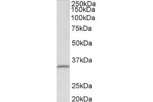 Western Blotting (WB) image for anti-Fibrillarin (FBL) (AA 99-110) antibody (ABIN5901192) (Fibrillarin antibody  (AA 99-110))