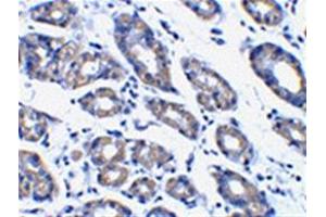 Image no. 2 for anti-Phorbol-12-Myristate-13-Acetate-Induced Protein 1 (PMAIP1) (N-Term) antibody (ABIN318707)