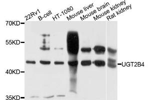 Western blot analysis of extracts of various cell lines, using μgT2B4 antibody (ABIN5972312) at 1/1000 dilution. (UGT2B4 antibody)