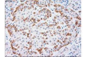 Immunohistochemistry (IHC) image for anti-Keratin 18 (KRT18) (AA 69-372) antibody (ABIN1491638)