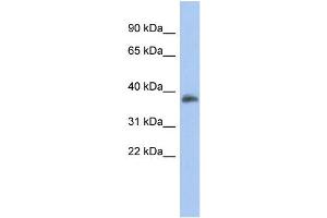 WB Suggested Anti-FOXB1 Antibody Titration:  0. (FOXB1 antibody  (Middle Region))