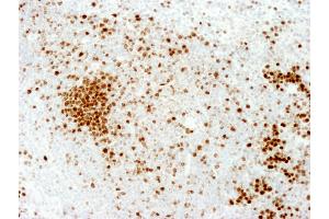 Immunohistochemistry (IHC) image for anti-Antigen Identified By Monoclonal Antibody Ki-67 (MKI67) (AA 1650-1700) antibody (ABIN7448620) (Ki-67 antibody  (AA 1650-1700))