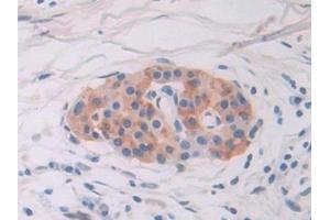 Immunohistochemistry (IHC) image for anti-Interferon, gamma-Inducible Protein 16 (IFI16) (AA 465-671) antibody (ABIN7442042)