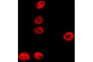 ABIN6275223 staining LOVO by IF/ICC. (REC8 antibody  (Internal Region))