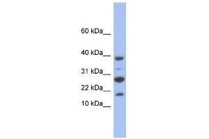 WB Suggested Anti-NDUFC1 Antibody Titration: 0. (NDUFC1 antibody  (Middle Region))
