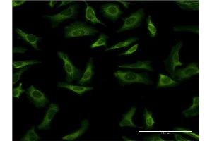 Immunofluorescence of monoclonal antibody to YWHAG on HeLa cell. (14-3-3 gamma antibody  (AA 1-247))