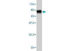 Western Blot detection against Immunogen (74. (NADK antibody  (AA 1-446))