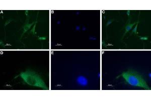 Expression of neuropeptide Y1 receptor in DRG neurons - Immunocytochemical staining of a primary culture of rat dorsal root ganglion (DRG) neurons. (NPY1R antibody  (AA 237-252))
