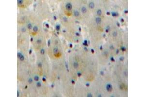 IHC-P analysis of Liver tissue, with DAB staining. (TLR6 antibody  (AA 17-239))