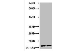 Western blot analysis of Hela, diluted at 1) 1:2000 2) 1:5000 (COX IV antibody)