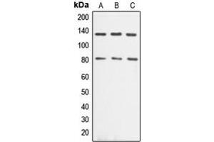 Western blot analysis of Alpha-adducin expression in Jurkat (A), HeLa (B), NIH3T3 (C) whole cell lysates. (alpha Adducin antibody  (C-Term))