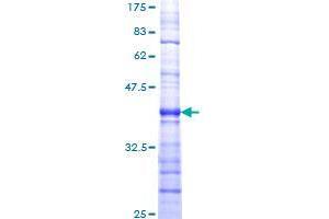 Image no. 1 for pi-3-Kinase-Related Kinase SMG-1 (SMG1) (AA 2922-3031) protein (GST tag) (ABIN1320674) (SMG1 Protein (AA 2922-3031) (GST tag))