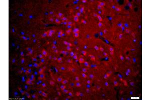Formalin-fixed and paraffin embedded rat brain labeled with Anti-5HT3A Receptor/SR-3A Polyclonal Antibody, Unconjugated (ABIN1386182) at 1:200 followed by conjugation to the secondary antibody Goat Anti-Rabbit IgG, Cy3 conjugated used at 1:200 dilution for 40 minutes at 37°C and DAPI staining