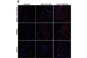 Validation of selected upregulated genes. (CXCL5 antibody  (AA 51-132))