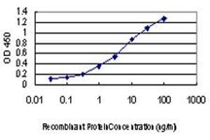Detection limit for recombinant GST tagged PKN2 is approximately 0. (PKN2 antibody  (AA 580-679))