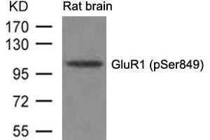 Western blot analysis of extracts from Rat brain tissue using GluR1(phospho-Ser849) Antibody. (Glutamate Receptor 1 antibody  (pSer849))