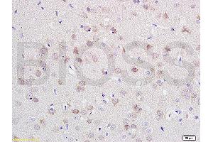 Formalin-fixed and paraffin embedded rat brain labeled with Anti-CDH2/N-cadherin Polyclonal Antibody, Unconjugated (ABIN738726) at 1:200 followed by conjugation to the secondary antibody and DAB staining. (N-Cadherin antibody  (AA 701-800))