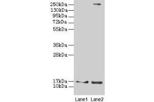 Western blot All lanes: CRABP1 antibody at 4 μg/mL Lane 1: Mouse eye tissue Lane 2: THP-1 whole cell lysate Secondary Goat polyclonal to rabbit IgG at 1/10000 dilution Predicted band size: 16 kDa Observed band size: 16 kDa (CRABP1 antibody  (AA 2-137))