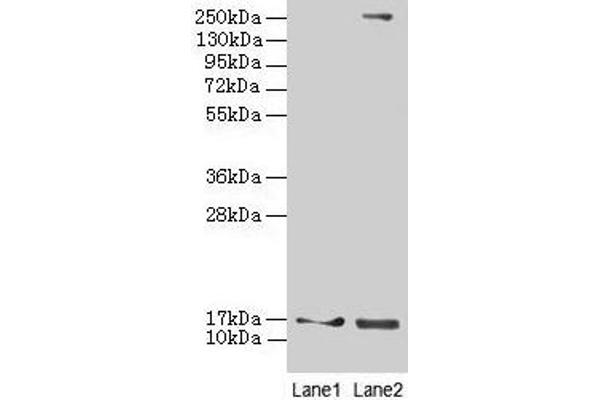 CRABP1 anticorps  (AA 2-137)