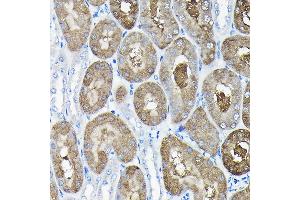 Immunohistochemistry of paraffin-embedded mouse kidney using TCP1 Rabbit pAb (ABIN6130046, ABIN6148956, ABIN6148957 and ABIN6217330) at dilution of 1:100 (40x lens). (TCP1 alpha/CCTA antibody  (AA 307-556))