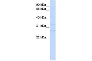 WB Suggested Anti-TMEM126B Antibody Titration:  0.