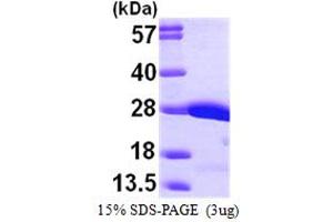 SDS-PAGE (SDS) image for V-Crk Sarcoma Virus CT10 Oncogene Homolog (Avian) (CRK) (AA 1-204) protein (His tag) (ABIN667252)