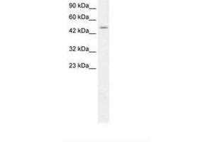 Image no. 1 for anti-Zinc Finger Protein 365 (ZNF365) (AA 75-124) antibody (ABIN203152) (ZNF365 antibody  (AA 75-124))