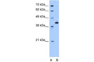 TOR2A antibody used at 1. (TOR2A antibody  (N-Term))