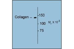 Image no. 1 for anti-Collagen, Type I (COL1) antibody (ABIN372600)
