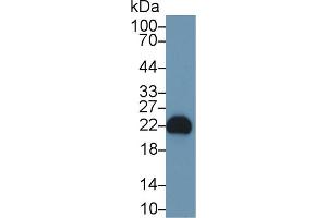 Detection of FGF12 in Rat Cerebrum lysate using Polyclonal Antibody to Fibroblast Growth Factor 12 (FGF12) (FGF12 antibody  (AA 1-181))