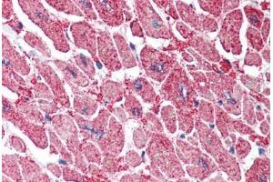 Human Heart (formalin-fixed, paraffin-embedded) stained with KPNA3 antibody ABIN337019 at 5 ug/ml followed by biotinylated anti-goat IgG secondary antibody ABIN481715, alkaline phosphatase-streptavidin and chromogen. (KPNA3 antibody  (AA 509-521))