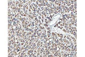 IHC analysis of TRK fused gene/TFG using anti-TRK fused gene/TFG antibody (ABIN7599839). (TFG antibody  (AA 121-400))