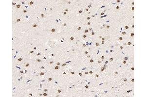Immunohistochemistry analysis of paraffin-embedded rat brain using HES2 Polyclonal Antibody at dilution of 1:200. (HES2 antibody)