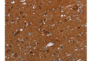 The image on the left is immunohistochemistry of paraffin-embedded Human brain tissue using ABIN7192423(SLC22A12 Antibody) at dilution 1/20, on the right is treated with synthetic peptide.